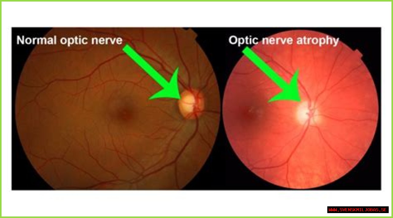 
                              Errol Spence Has Torn Retina Surgically Repaired, Shares Photo After Procedure
                    
                          Errol Spence
                          Out Of Surgery
                          ... To Repair Torn Retina
                      
        
        
          
                          
                Breaking News
              
                        
              
                
                                  1.7K
                              
            
            
              
                
              
            
          

                      8/10/2021 12:07 PM PT
                  
      